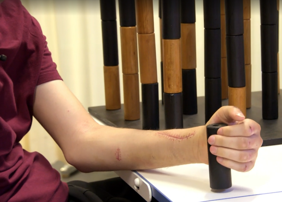 Gelähmte Hand 2 © SRF Puls